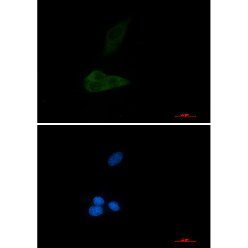 Anti-MAP3K4 Rabbit Monoclonal Antibody