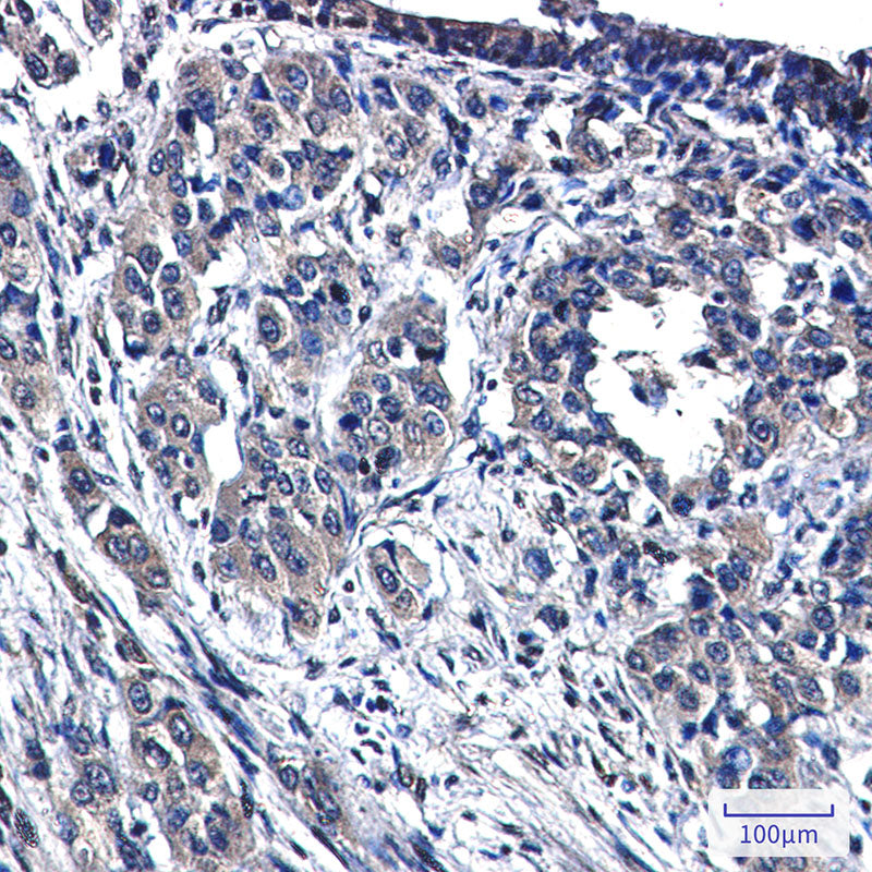 Anti-MAP3K4 Rabbit Monoclonal Antibody