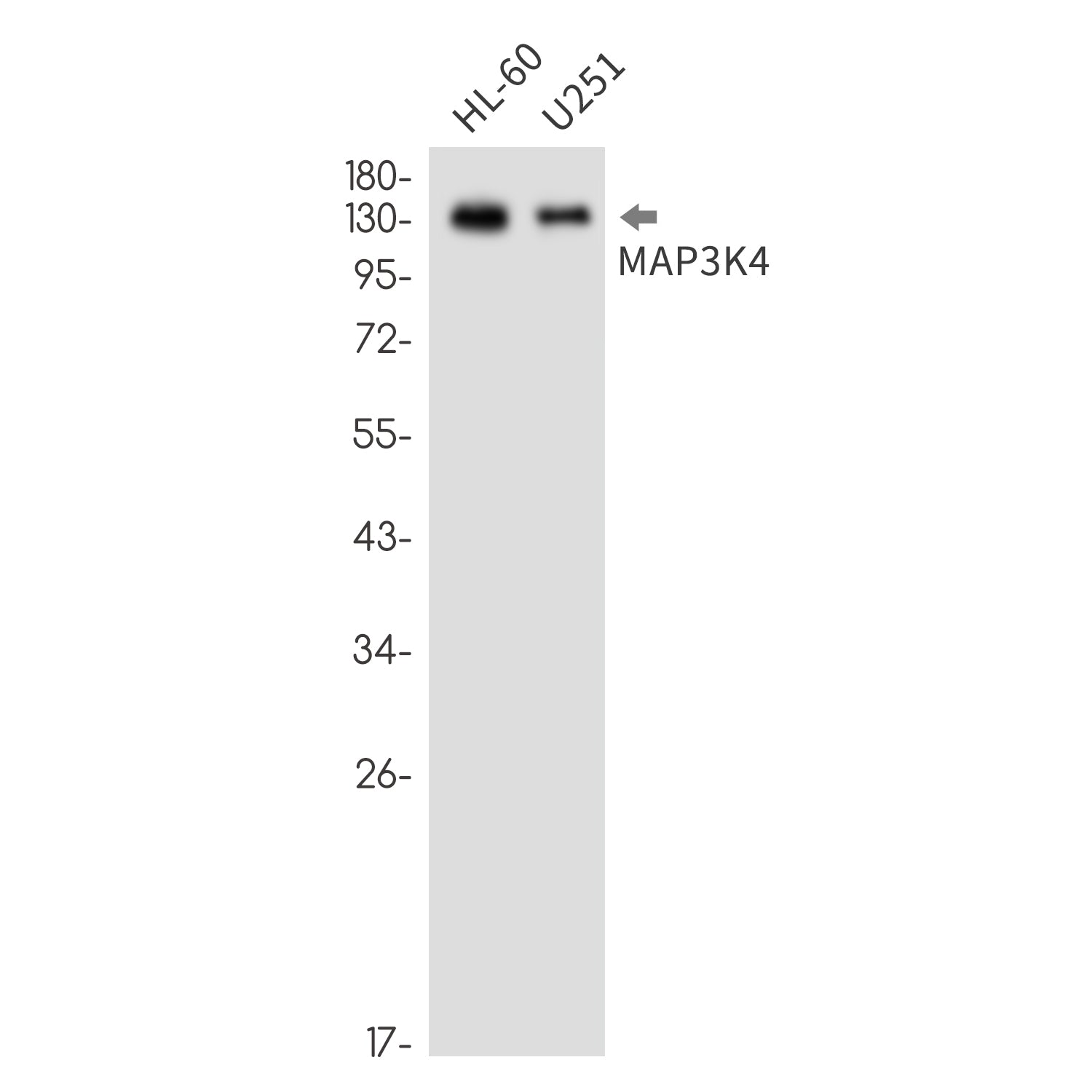Anti-MAP3K4 Rabbit Monoclonal Antibody