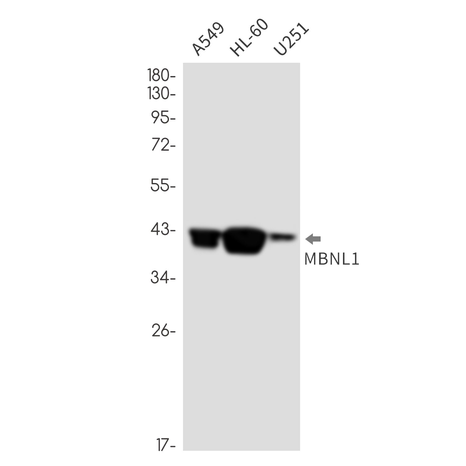 Anti-MBNL1 Rabbit Monoclonal Antibody