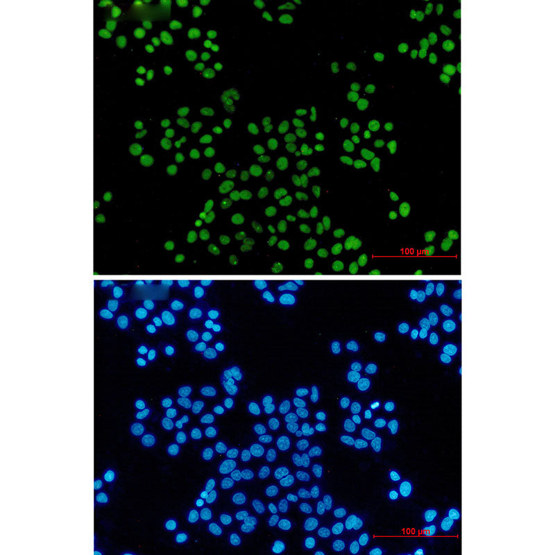 Anti-MCM2 Rabbit Monoclonal Antibody