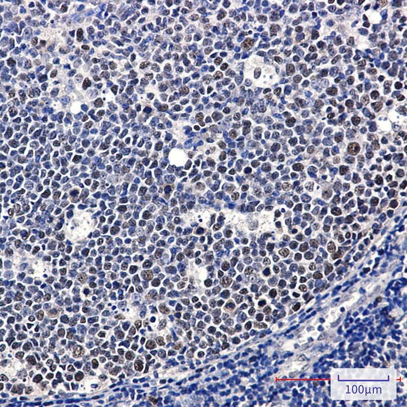 Anti-MCM2 Rabbit Monoclonal Antibody