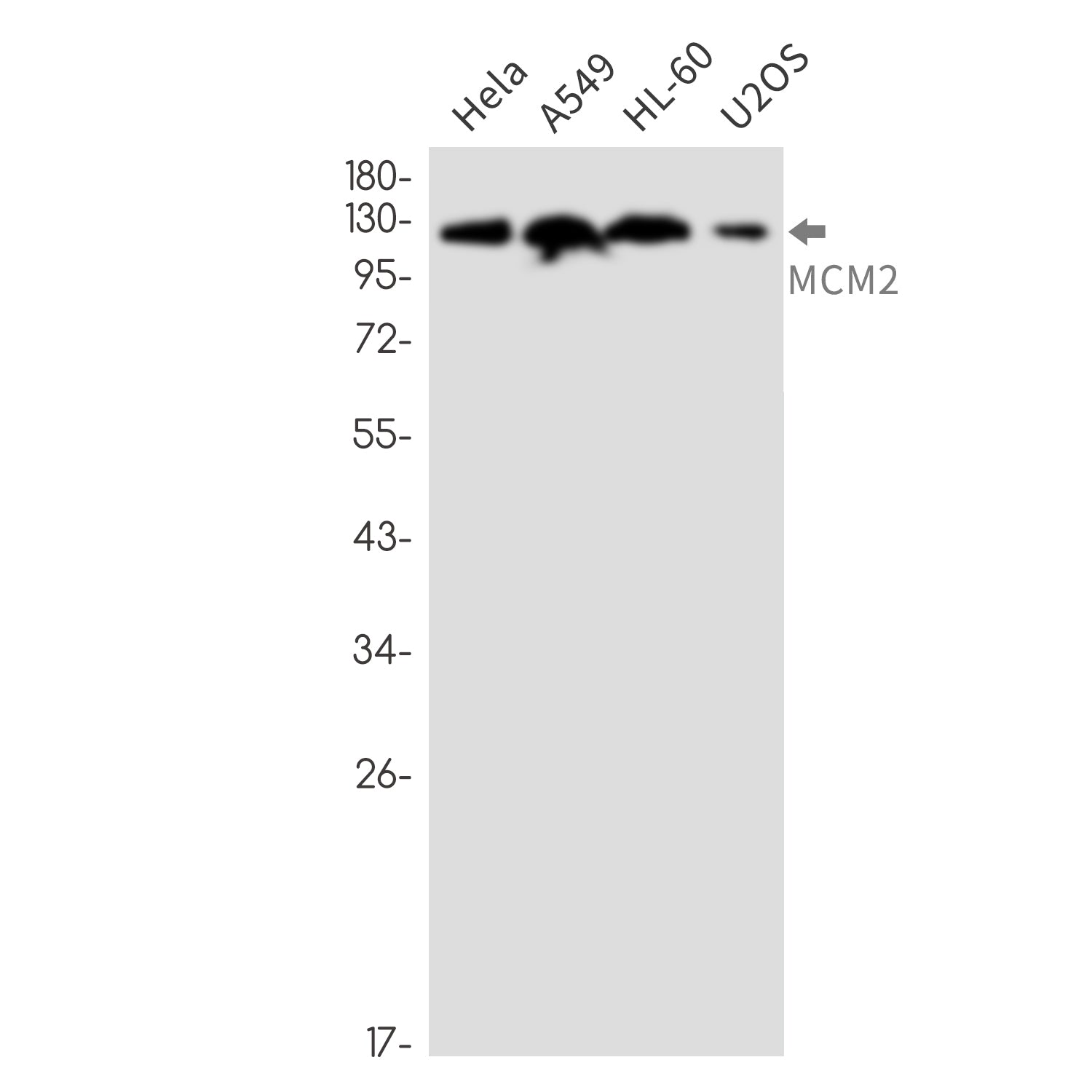 Anti-MCM2 Rabbit Monoclonal Antibody