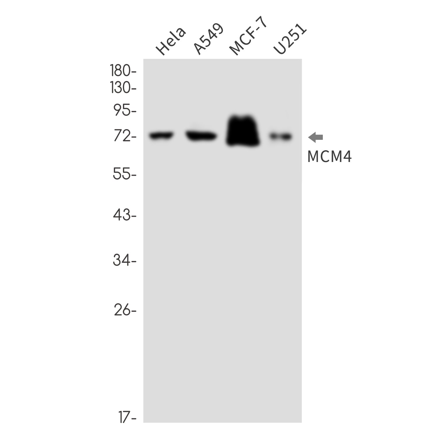 Anti-MCM4 Rabbit Monoclonal Antibody