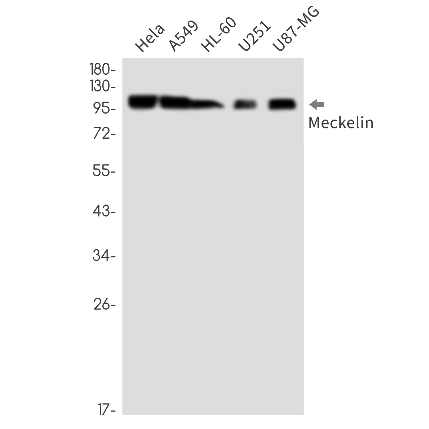 Anti-Meckelin Rabbit Monoclonal Antibody