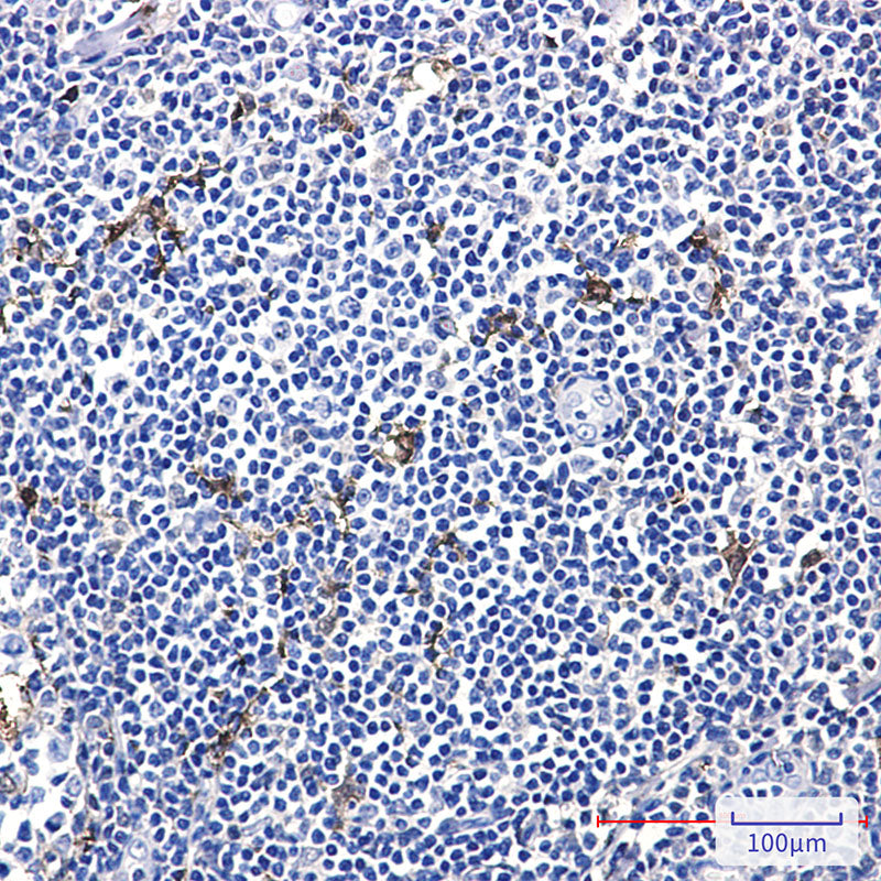 Anti-MERTK Rabbit Monoclonal Antibody