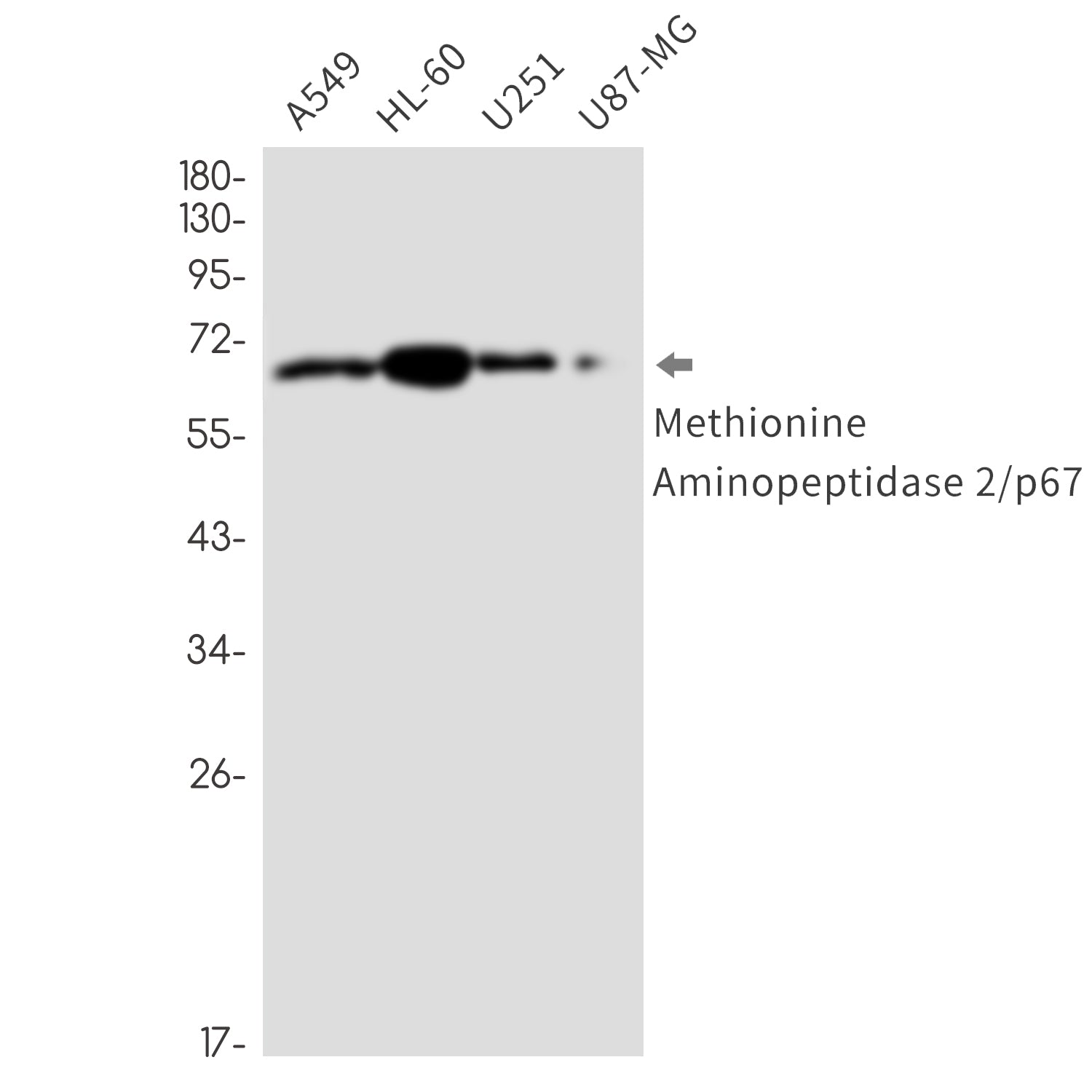 Anti-Methionine Aminopeptidase 2 Rabbit Monoclonal Antibody