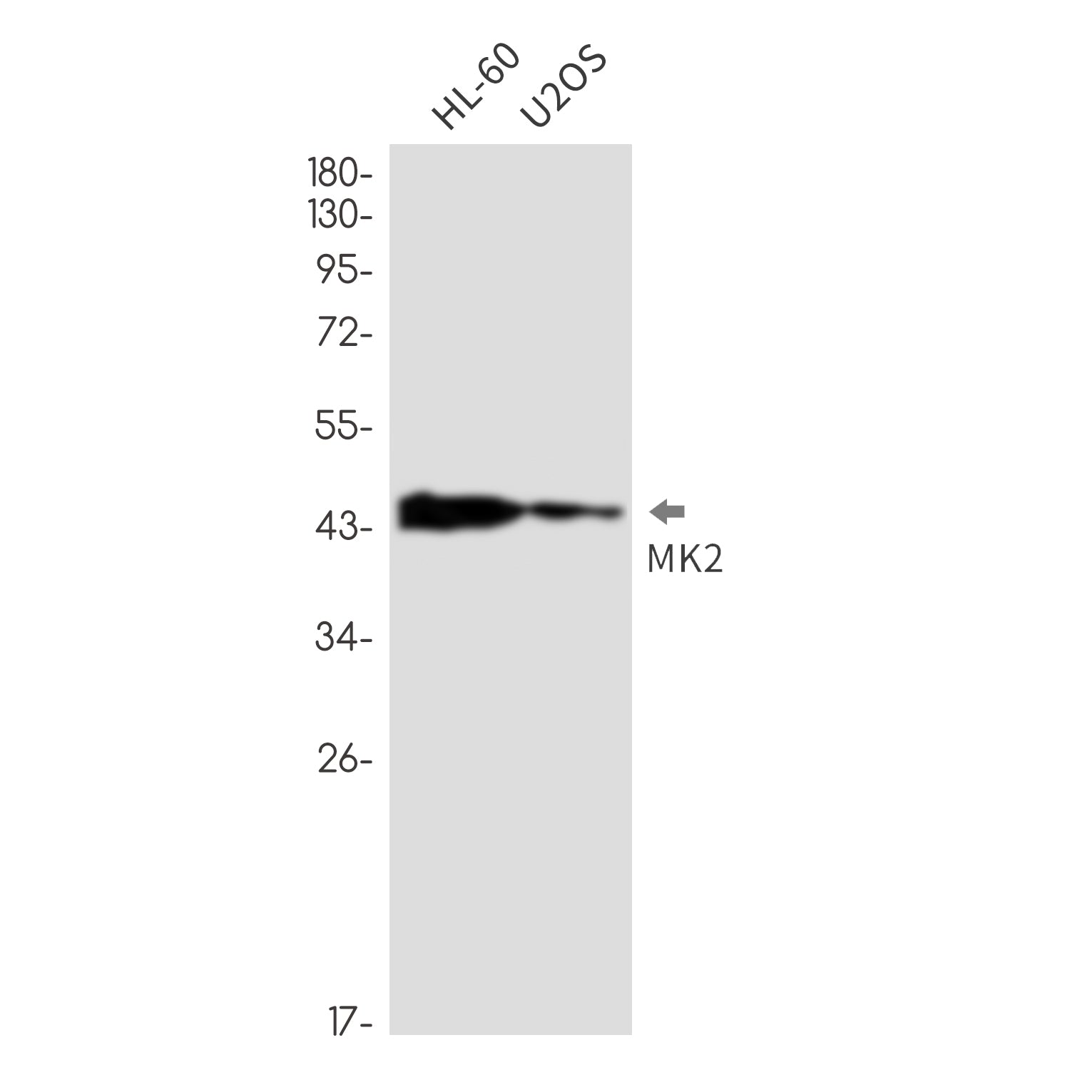 Anti-MAPKAP Kinase 2 Rabbit Monoclonal Antibody