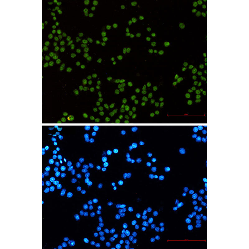 Anti-MLH1 Rabbit Monoclonal Antibody