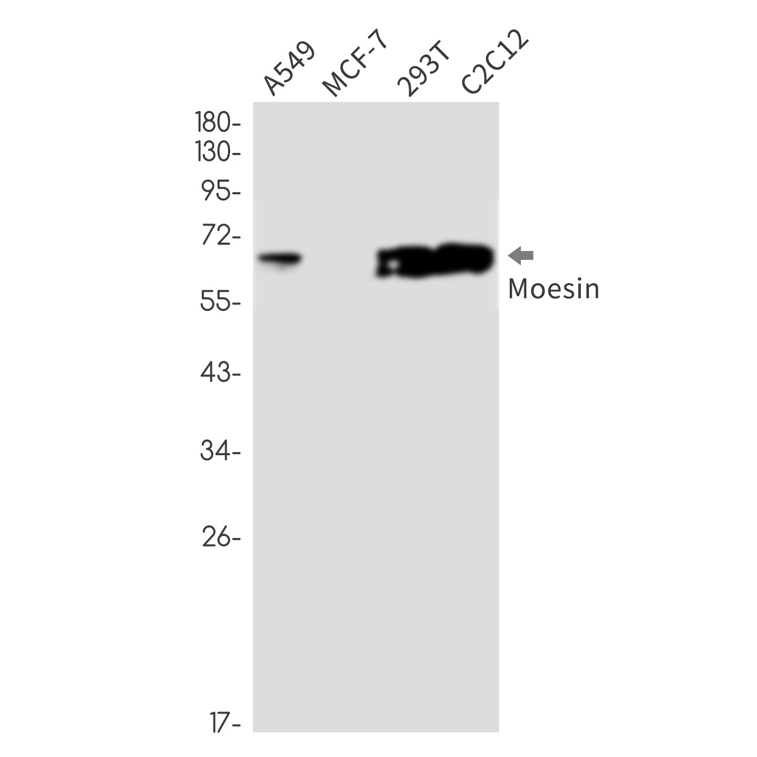 Anti-Moesin Rabbit Monoclonal Antibody