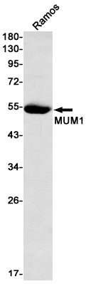 Anti-Interferon Regulatory Factor 4 Rabbit Monoclonal Antibody