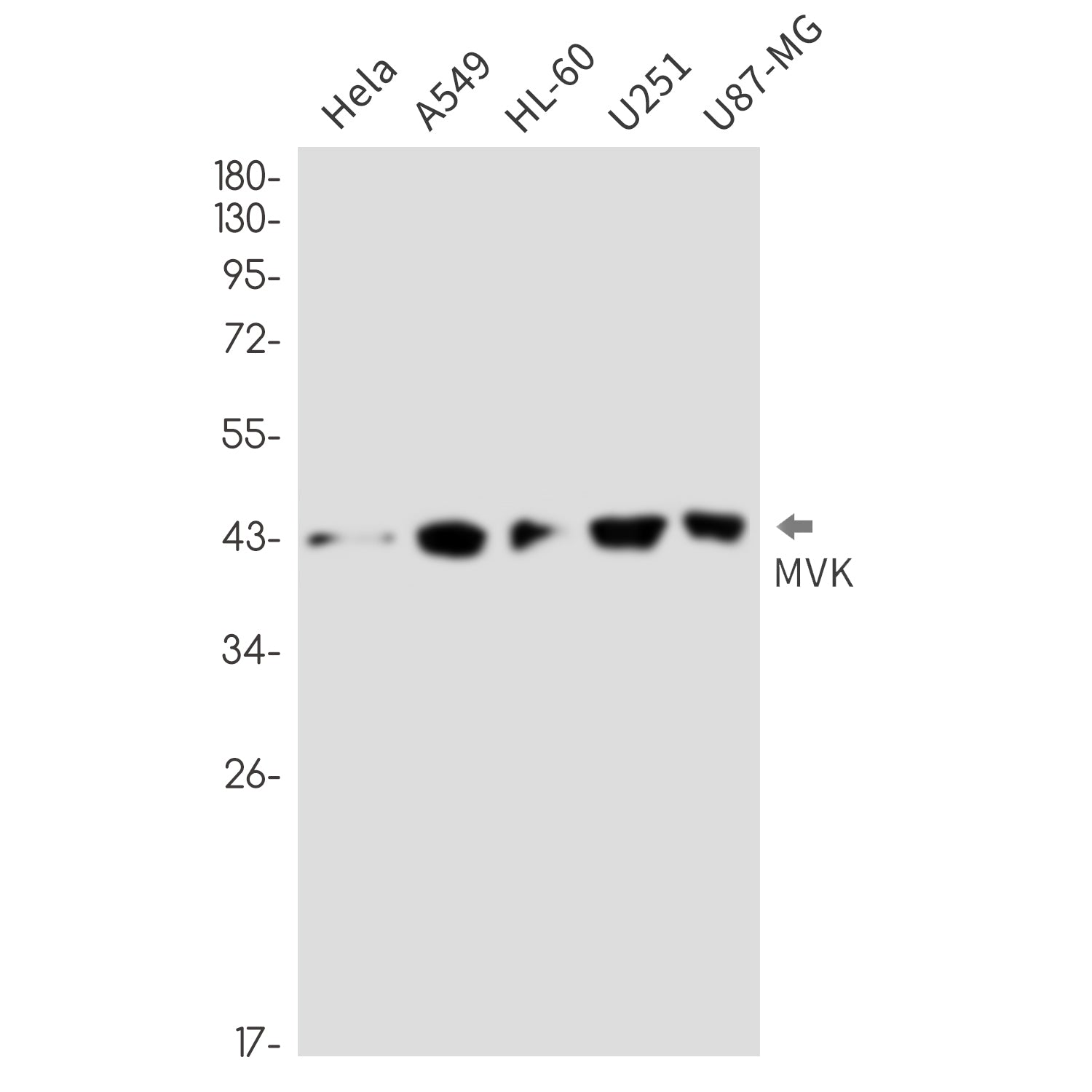 Anti-MVK Rabbit Monoclonal Antibody