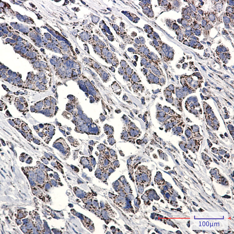 Anti-NDUFS1 Rabbit Monoclonal Antibody
