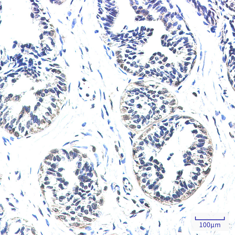 Anti-NDUFS2 Rabbit Monoclonal Antibody