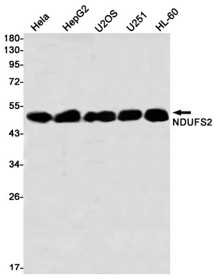 Anti-NDUFS2 Rabbit Monoclonal Antibody