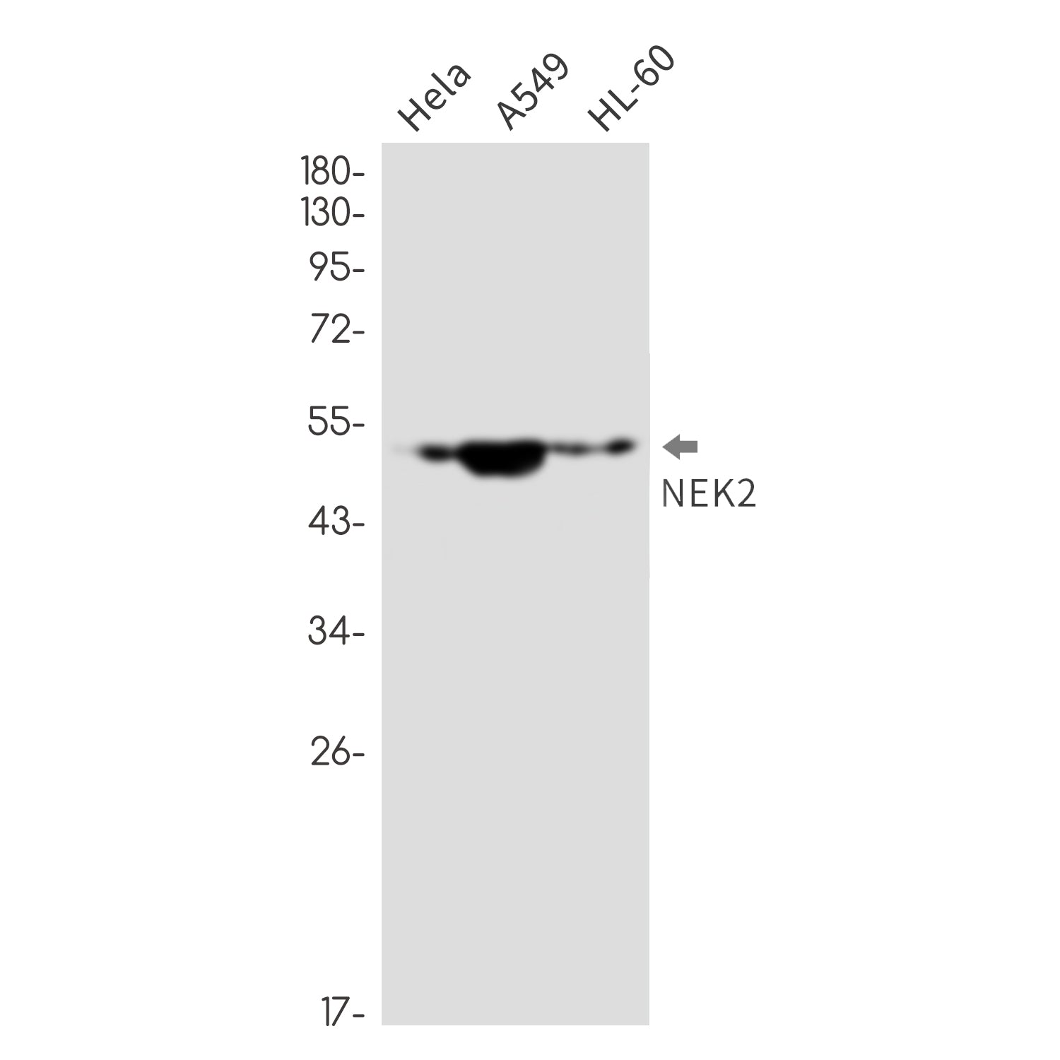Anti-NEK2 Rabbit Monoclonal Antibody