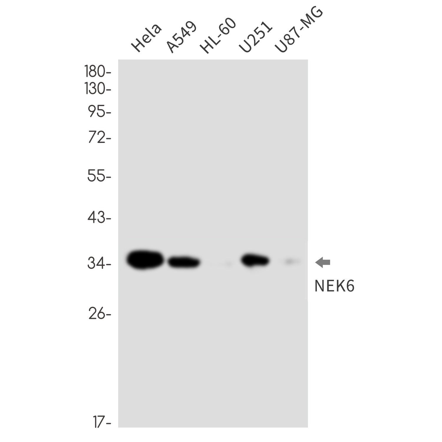 Anti-NEK6 Rabbit Monoclonal Antibody