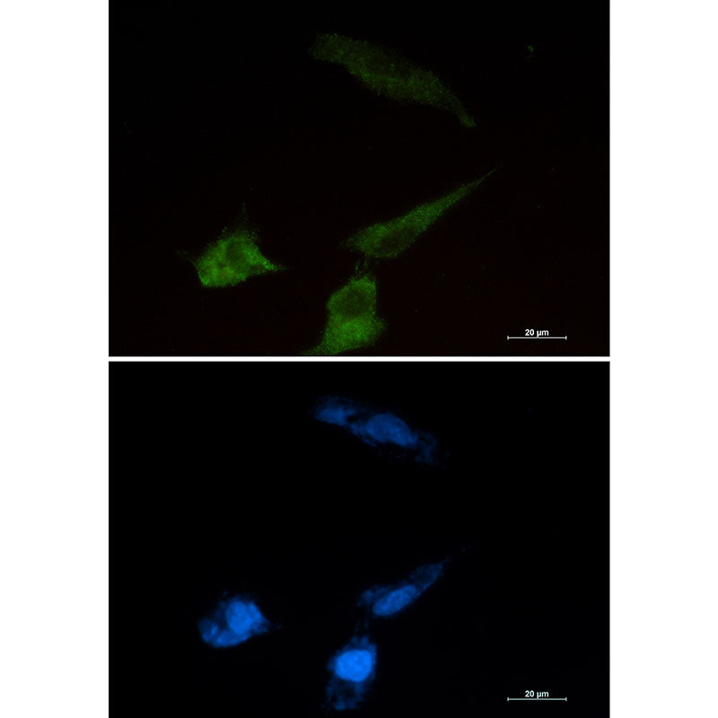 Anti-Niemann Pick C2 Rabbit Monoclonal Antibody