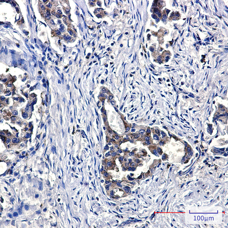 Anti-Niemann Pick C2 Rabbit Monoclonal Antibody