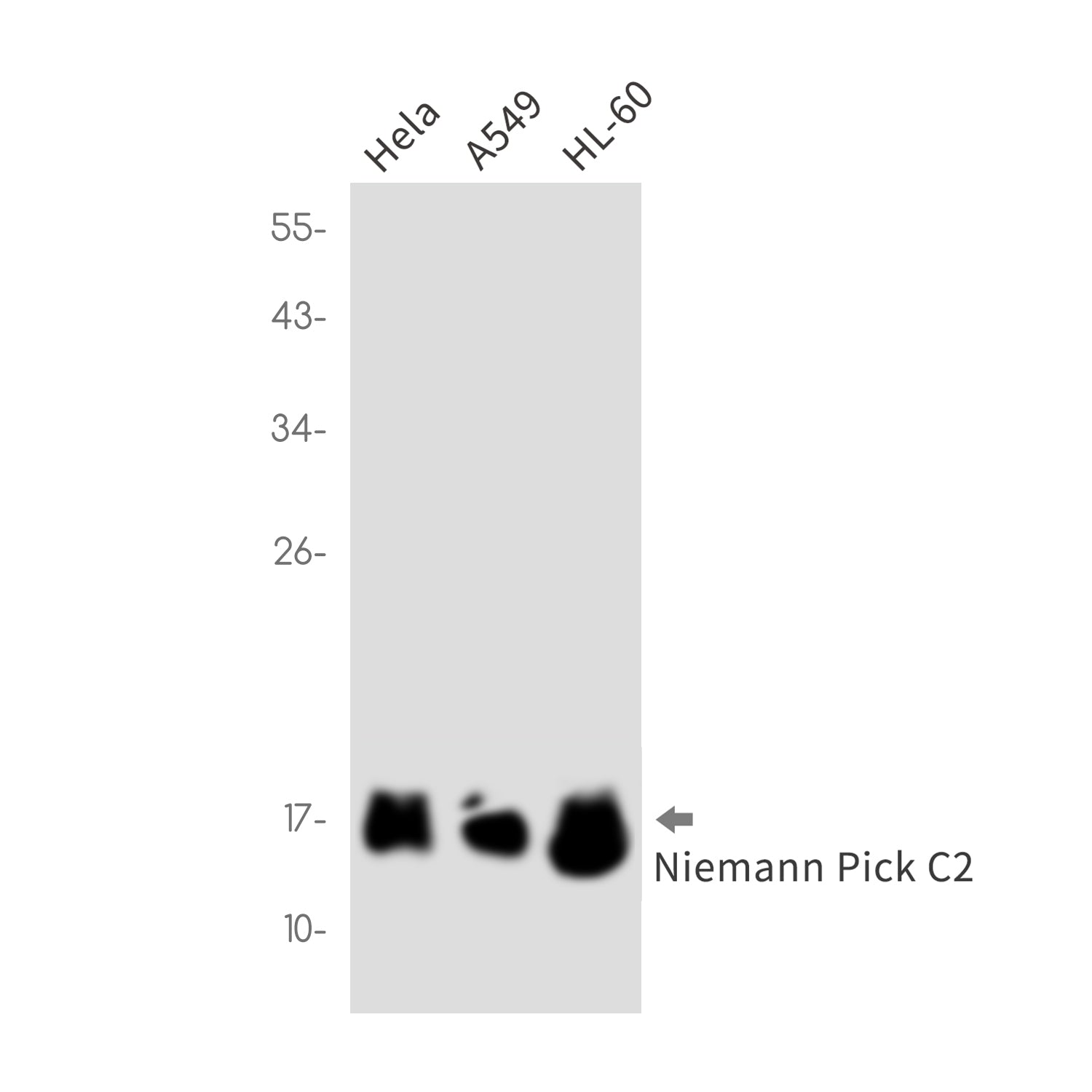 Anti-Niemann Pick C2 Rabbit Monoclonal Antibody