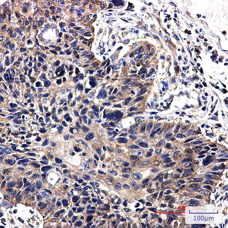 Anti-NME2 Rabbit Monoclonal Antibody