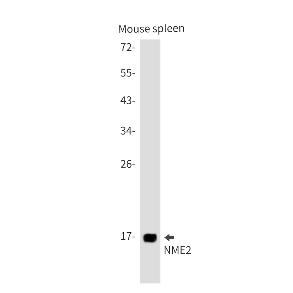 Anti-NME2 Rabbit Monoclonal Antibody