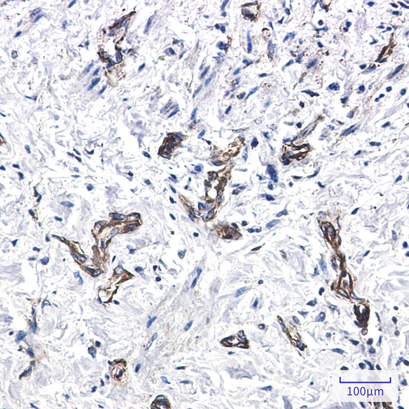 Anti-MYH9 Rabbit Monoclonal Antibody
