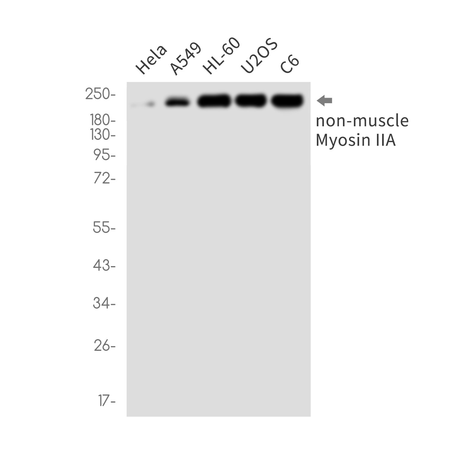 Anti-MYH9 Rabbit Monoclonal Antibody