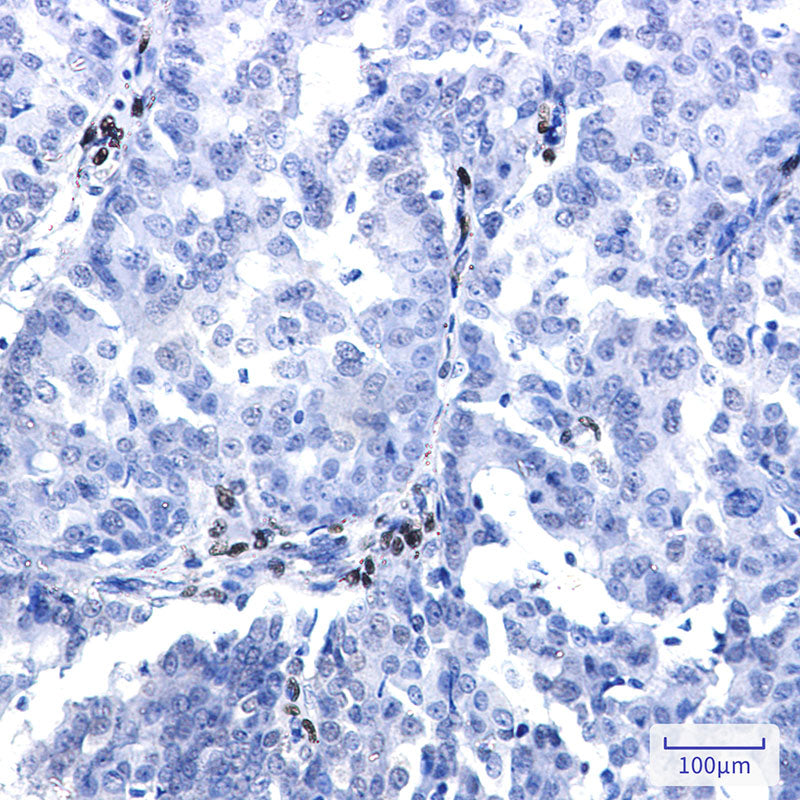 Anti-NR2F2 Rabbit Monoclonal Antibody