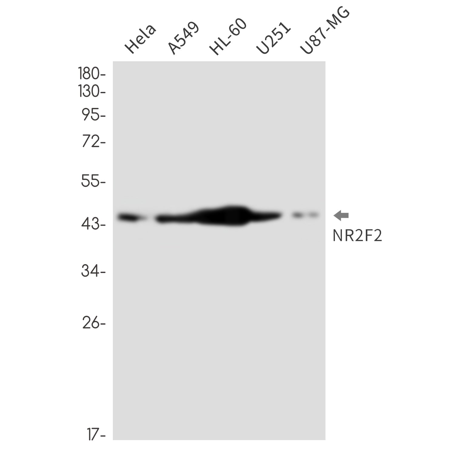 Anti-NR2F2 Rabbit Monoclonal Antibody