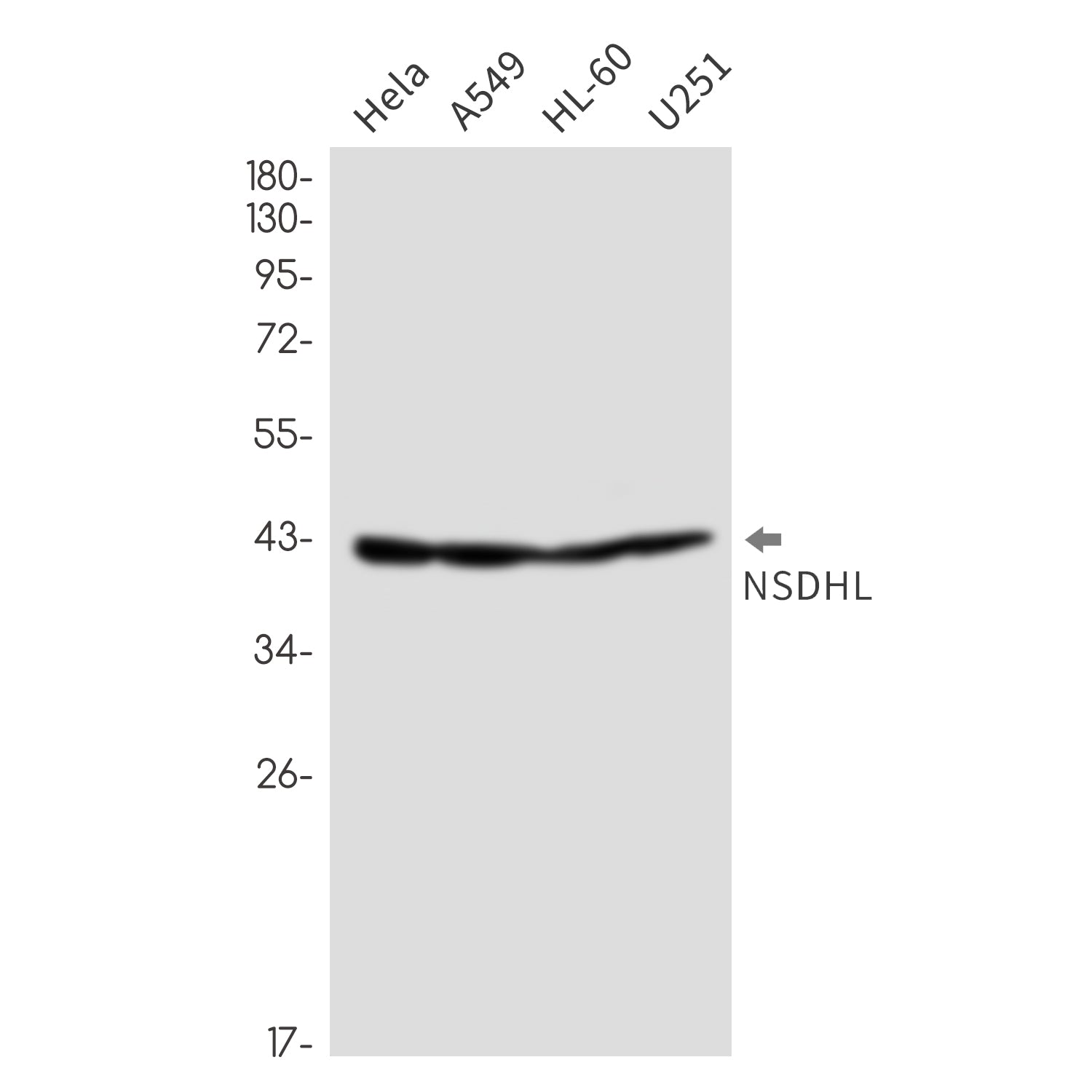 Anti-NSDHL Rabbit Monoclonal Antibody