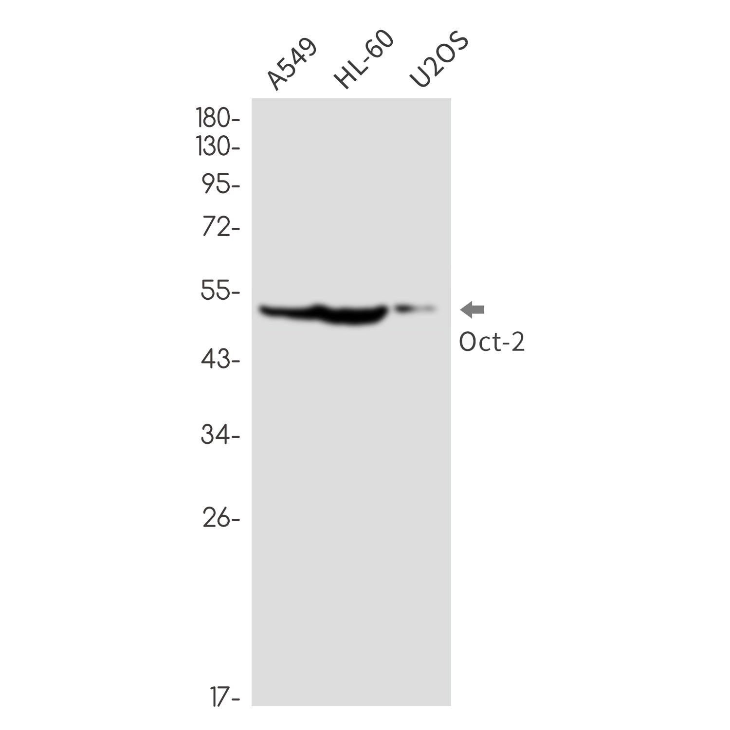 Anti-Oct-2 Rabbit Monoclonal Antibody