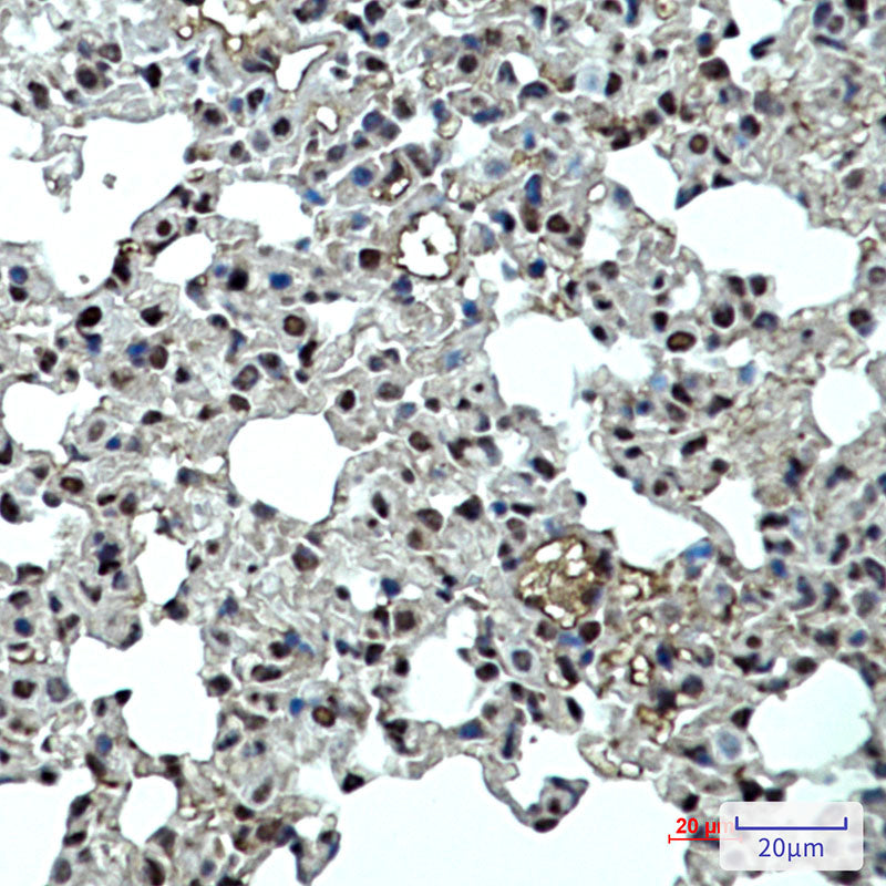 Anti-p27 Kip 1 Rabbit Monoclonal Antibody