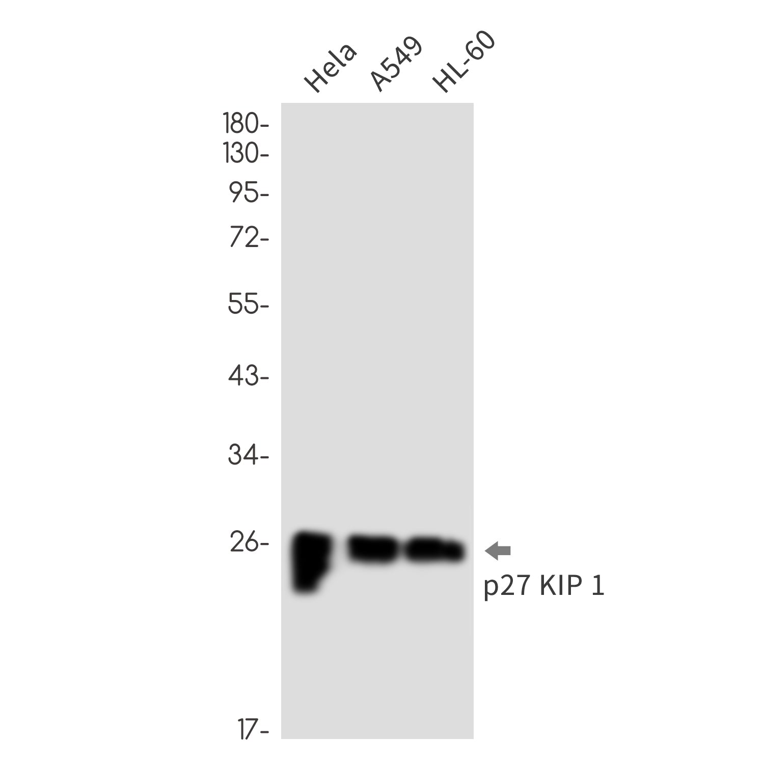 Anti-p27 Kip 1 Rabbit Monoclonal Antibody