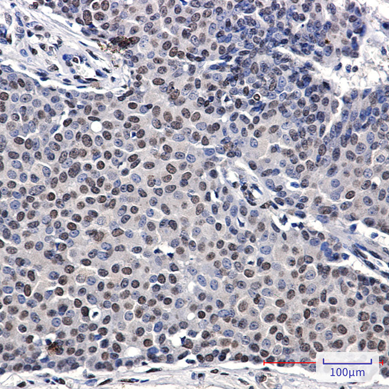 Anti-p57 Kip2 Rabbit Monoclonal Antibody
