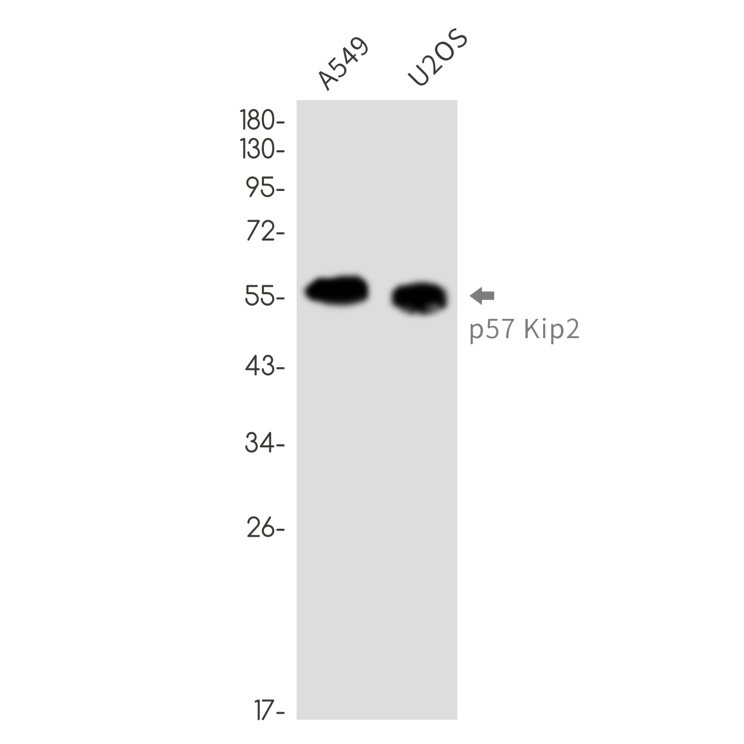 Anti-p57 Kip2 Rabbit Monoclonal Antibody
