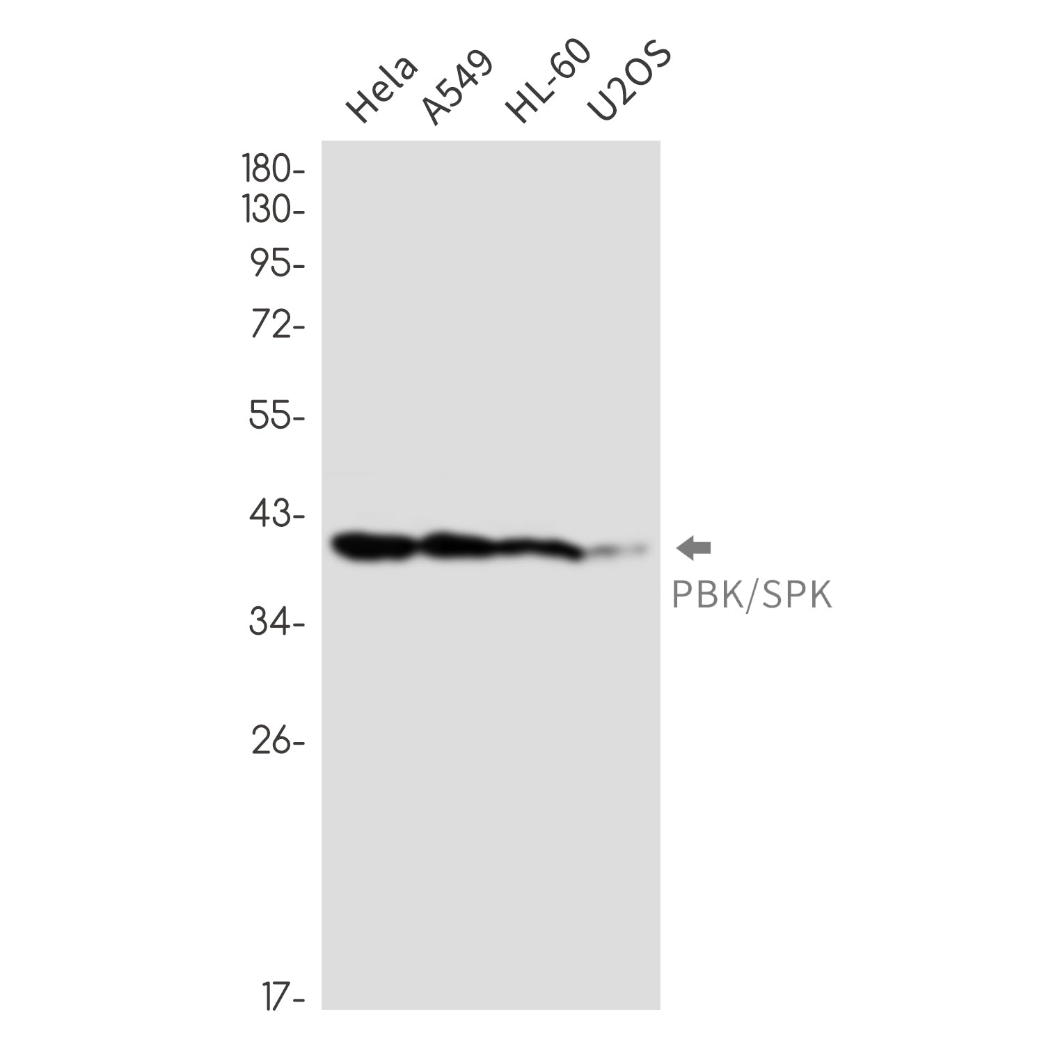 Anti-PBK Rabbit Monoclonal Antibody