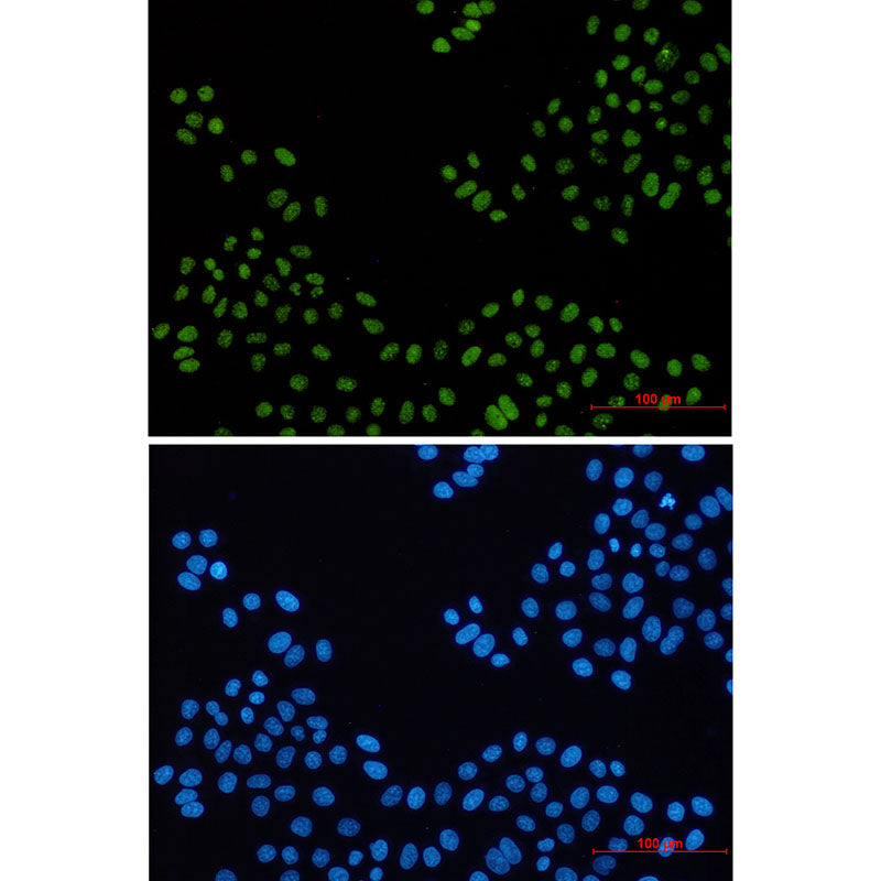 Anti-PELP1 Rabbit Monoclonal Antibody