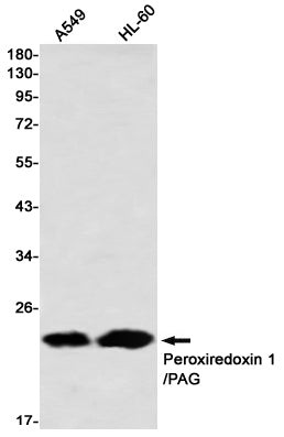 Anti-Peroxiredoxin 1 Rabbit Monoclonal Antibody
