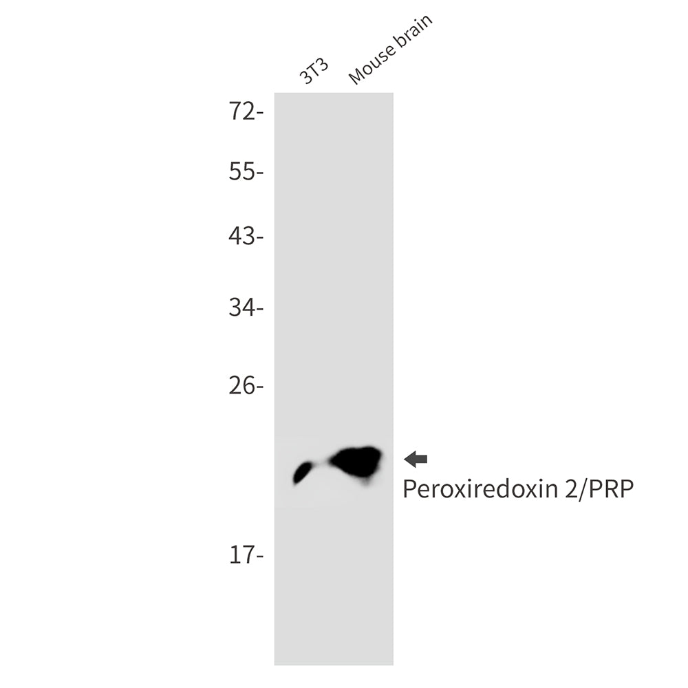 Anti-Peroxiredoxin 2 Rabbit Monoclonal Antibody