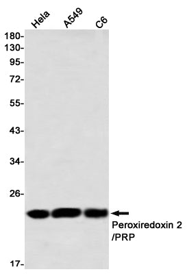 Anti-Peroxiredoxin 2 Rabbit Monoclonal Antibody