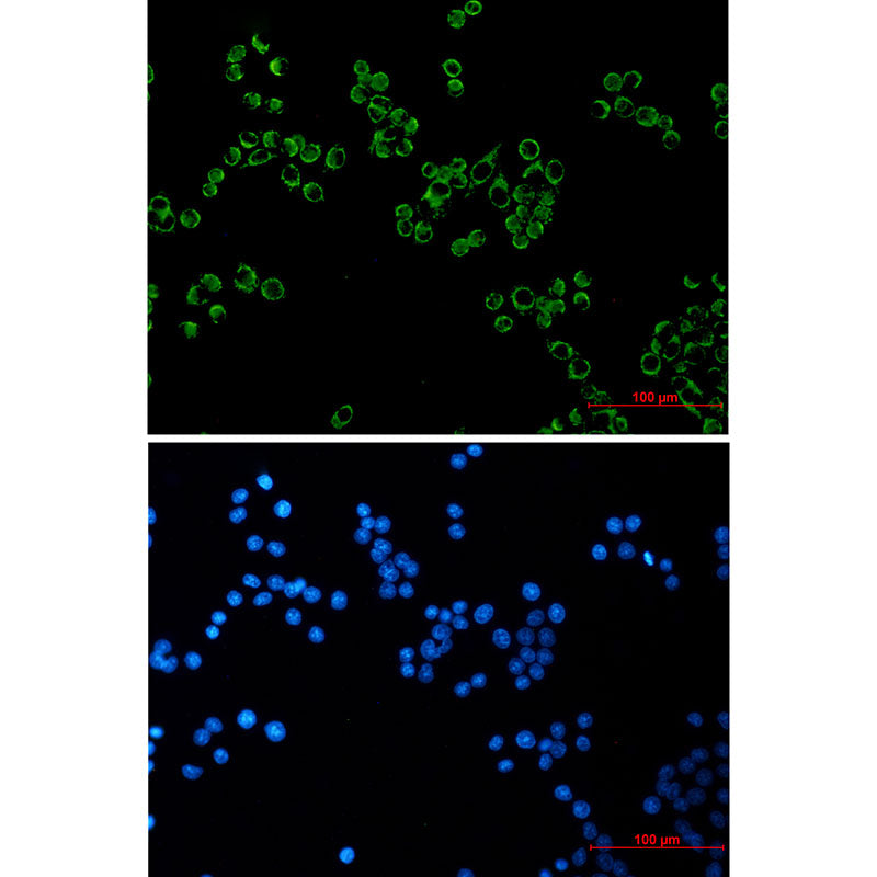 Anti-Peroxiredoxin 3 Rabbit Monoclonal Antibody