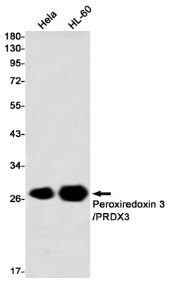 Anti-Peroxiredoxin 3 Rabbit Monoclonal Antibody