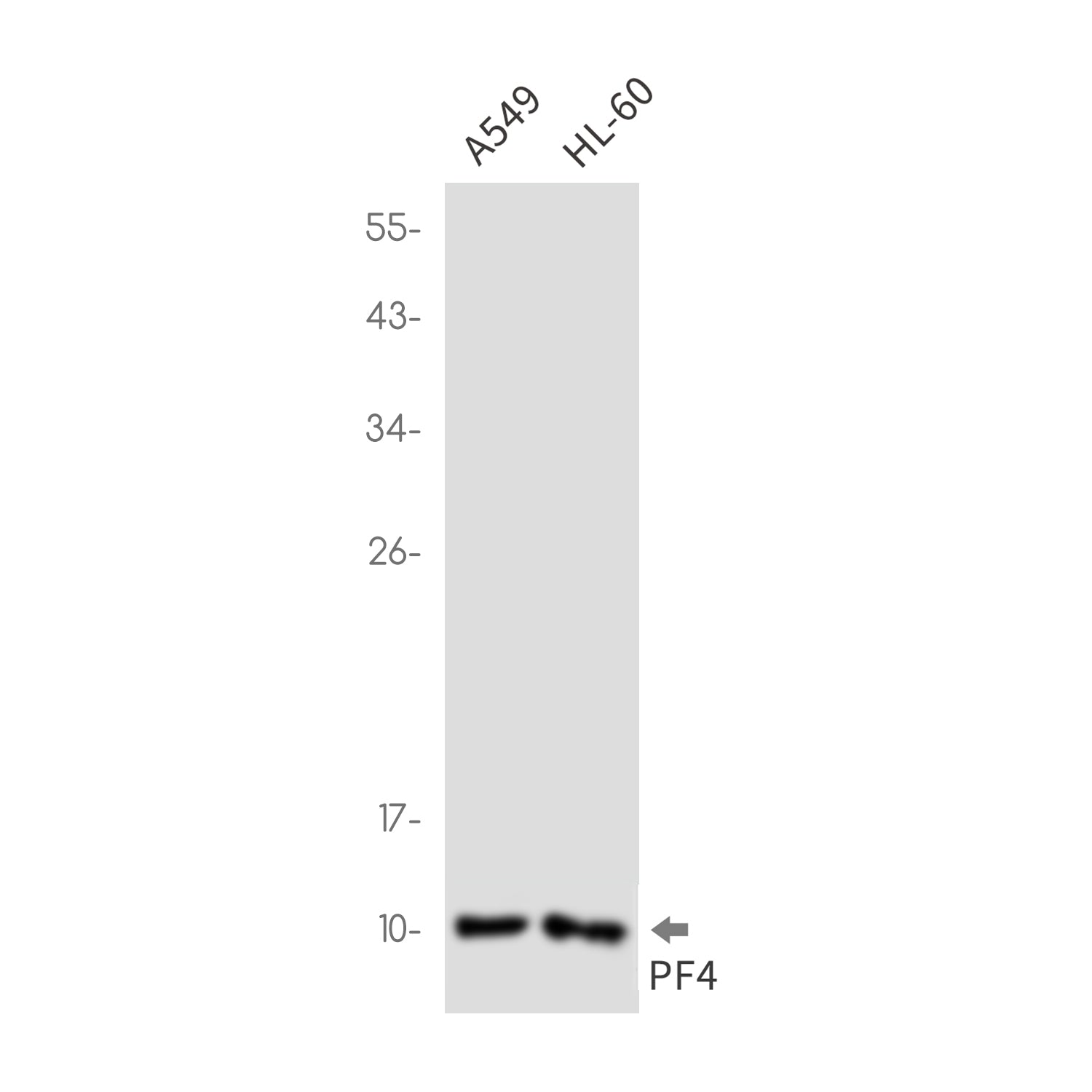 Anti-PF4 Rabbit Monoclonal Antibody