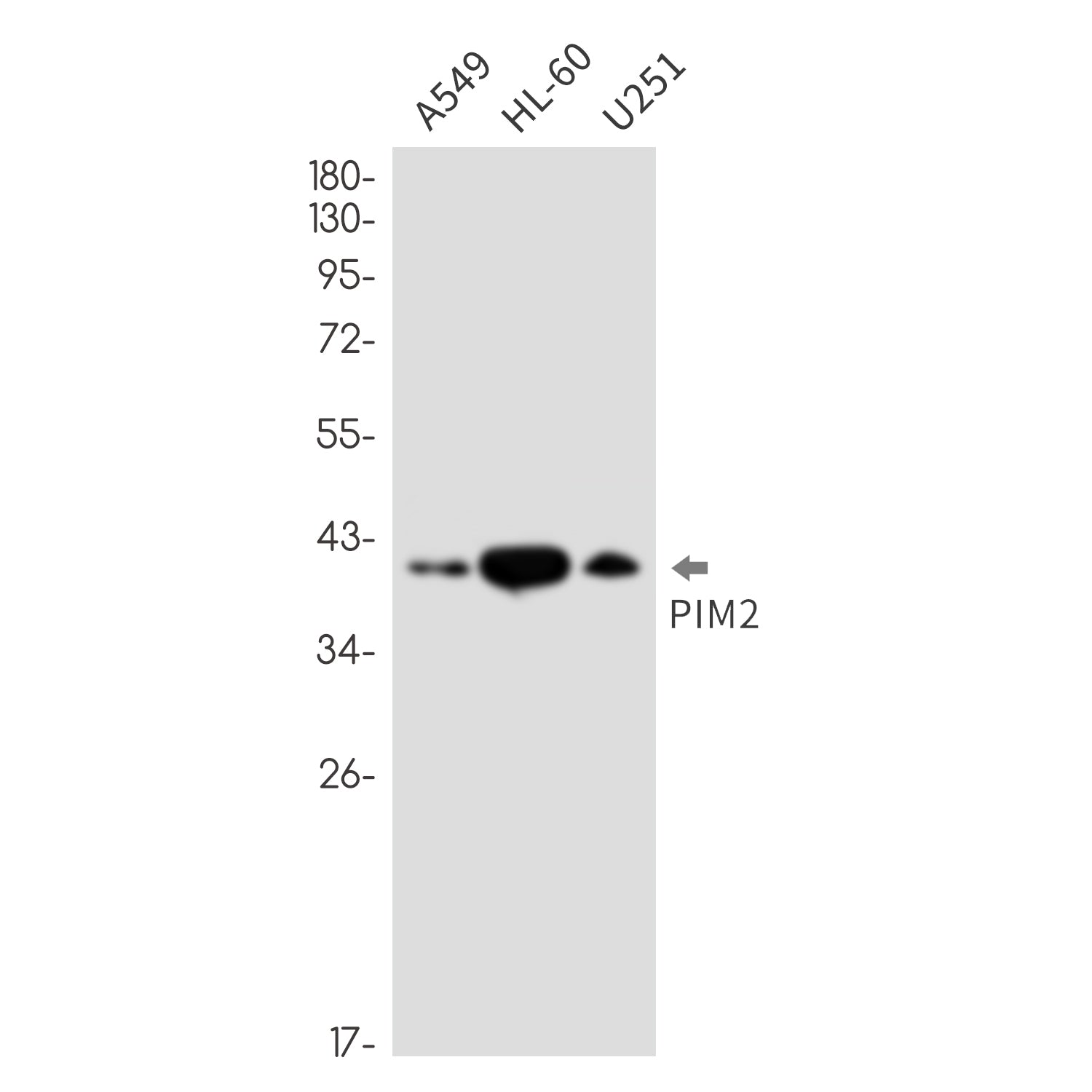Anti-PIM2 Rabbit Monoclonal Antibody