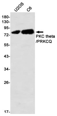 Anti-PKC theta Rabbit Monoclonal Antibody