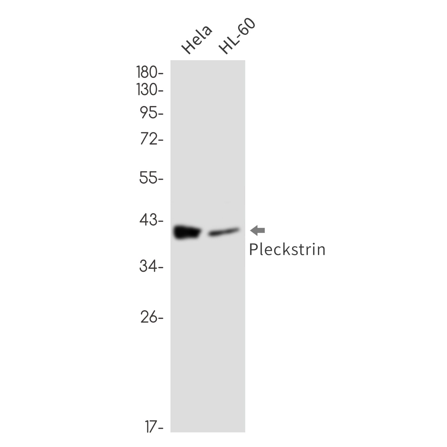 Anti-Pleckstrin Rabbit Monoclonal Antibody