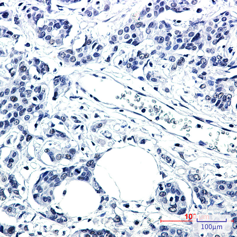 Anti-PNKP Rabbit Monoclonal Antibody