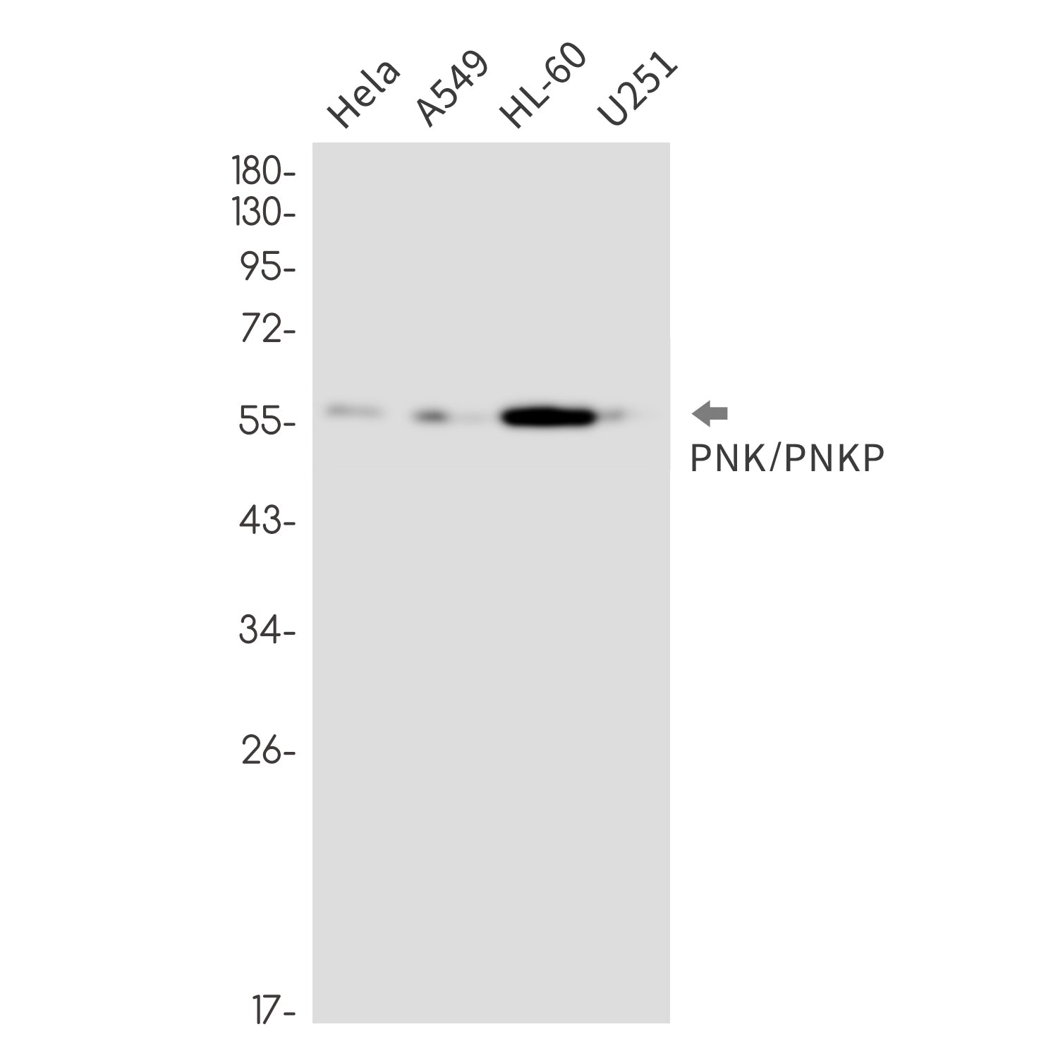 Anti-PNKP Rabbit Monoclonal Antibody