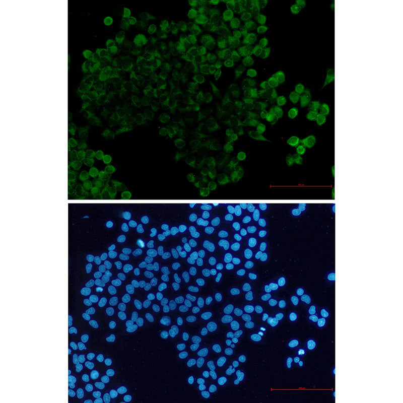 Anti-PPP2R5E Rabbit Monoclonal Antibody